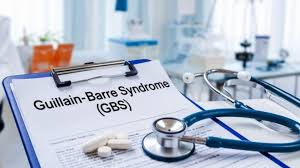 गुइलेन बैरे सिंड्रोम (GBS) से 56 वर्षीय महिला की मौत